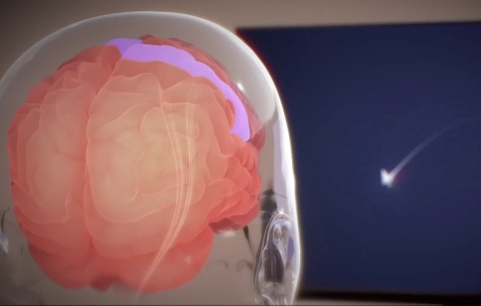 Neuralink's graphic showing the chip aiding a part of the brain to move a mouse pointer