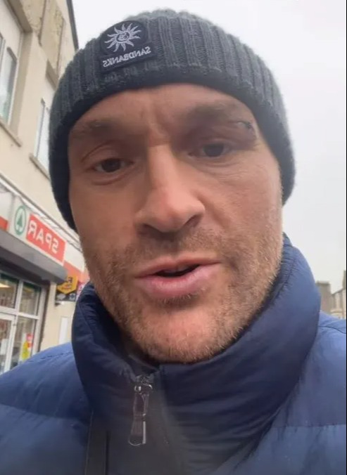 Fury showed off his horror eye injury
