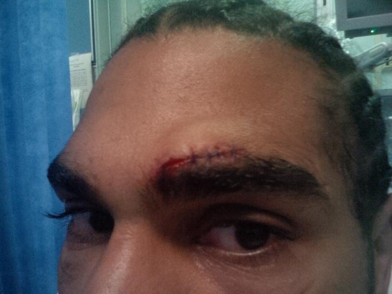 Fury wasn't as kind when David Haye was forced to pull out of their 2013 clash due to a cut