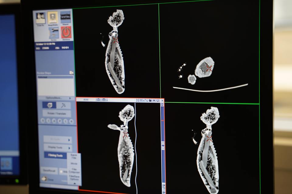 CT scan reports of the odd creature