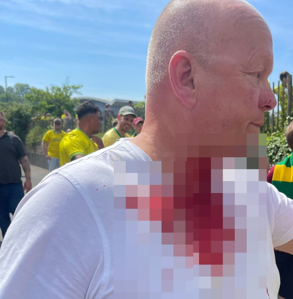 A Leeds fan was reportedly slashed outside Carrow Road