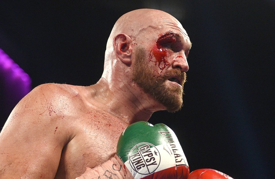 Fury suffered this HORROR gash in his fight against Otto Wallin