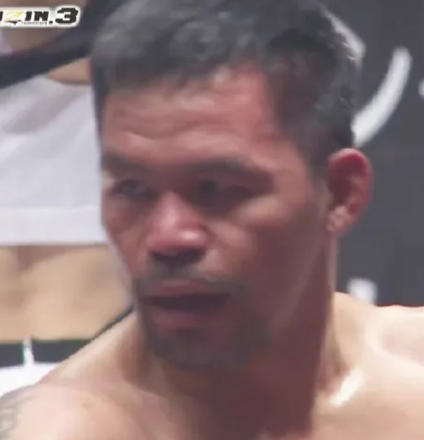 He looked to be in shock at the end after he took some heavy blows