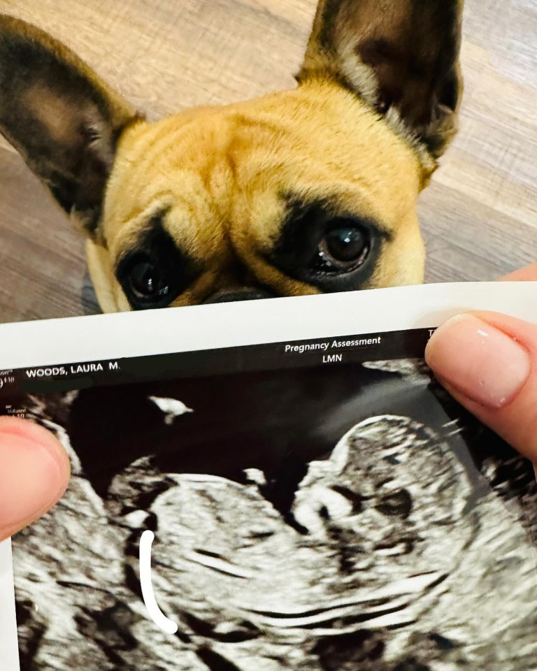 Adam and Laura announced their baby news with this picture