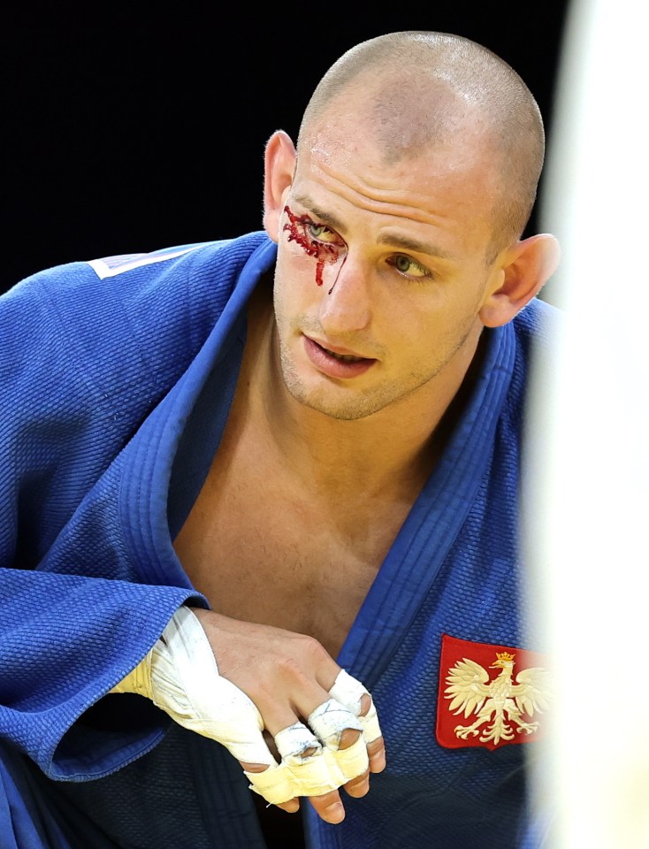 He was beaten by Zelym Kotsoiev