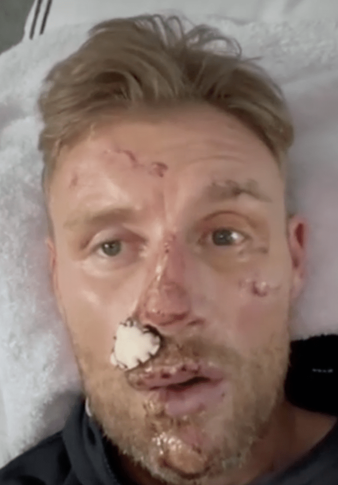 a man with a bandage on his nose looks at the camera