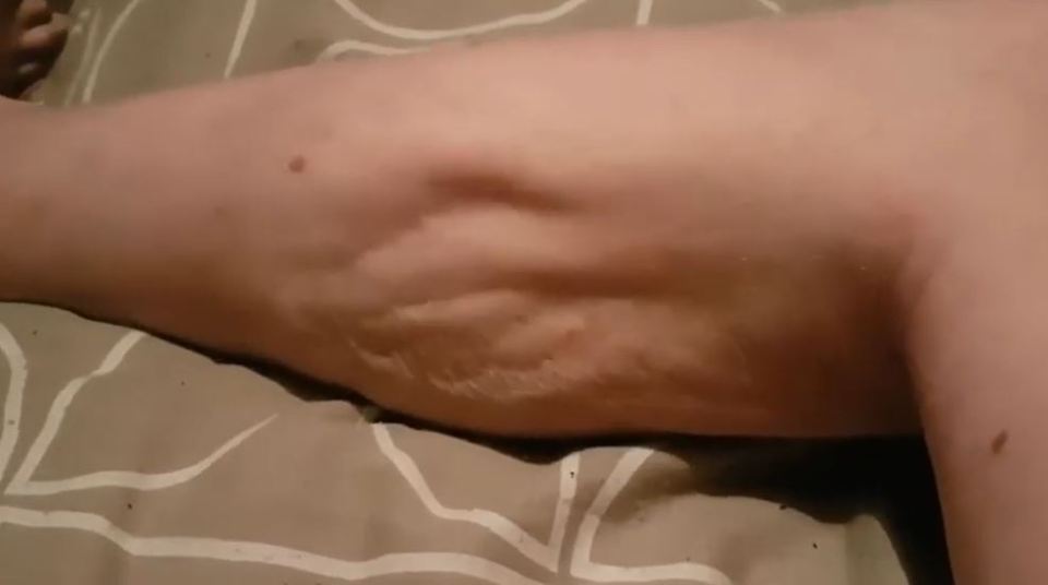 a close up of a person 's arm on a bed