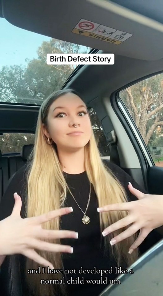 a woman in a car with a birth defect story written above her