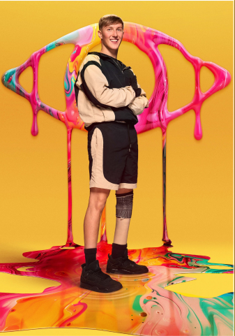 a man with a prosthetic leg stands in front of a colorful painting