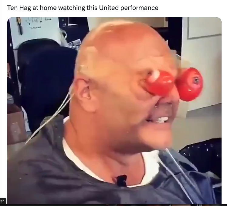 a man wearing a clown nose is watching a united performance