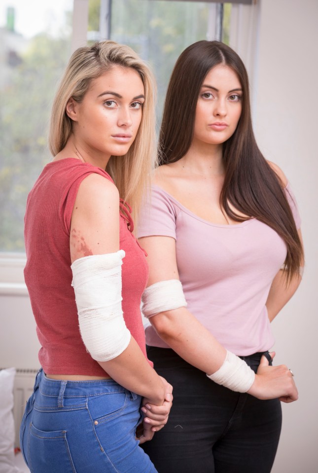 two women standing next to each other with bandages on their elbows