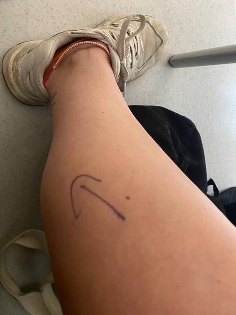 a person 's leg with a drawing of an arrow on it