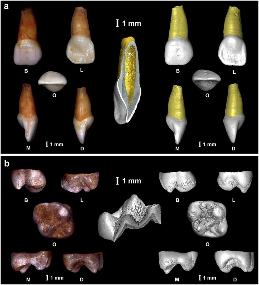 a picture of a tooth with the letter i on it