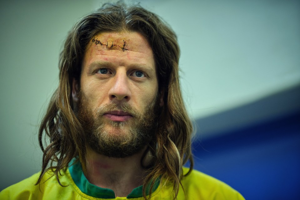 a man with long hair and a beard has stitches on his forehead