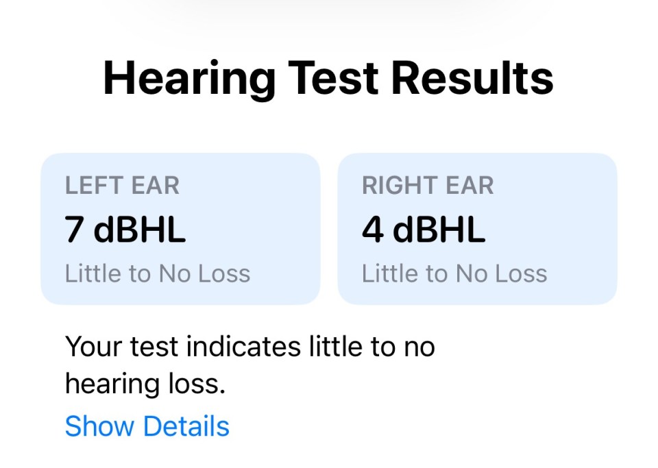 Hearing test results: Left ear 7 dBHL, right ear 4 dBHL; little to no hearing loss.