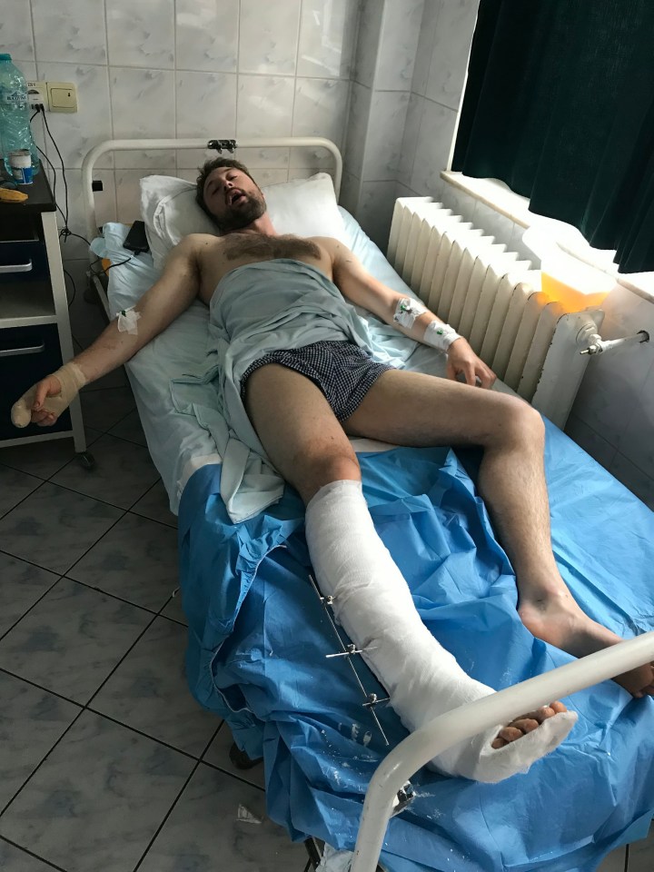 Man in hospital bed with leg cast.