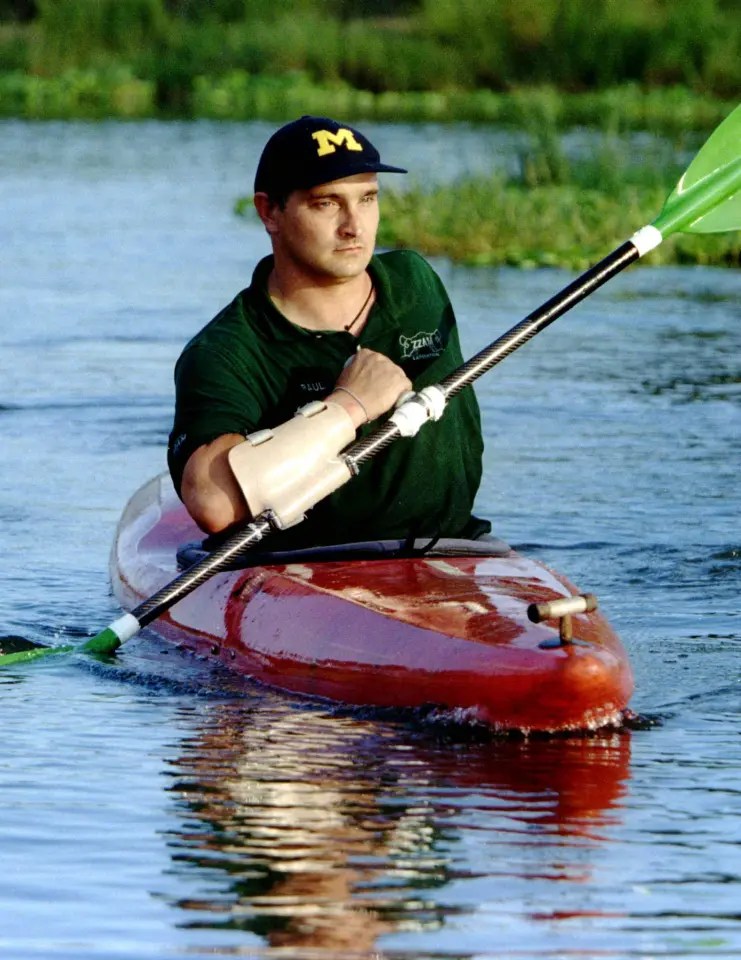 Man with prosthetic arm kayaking.