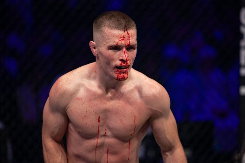 Bloody fighter after a match.