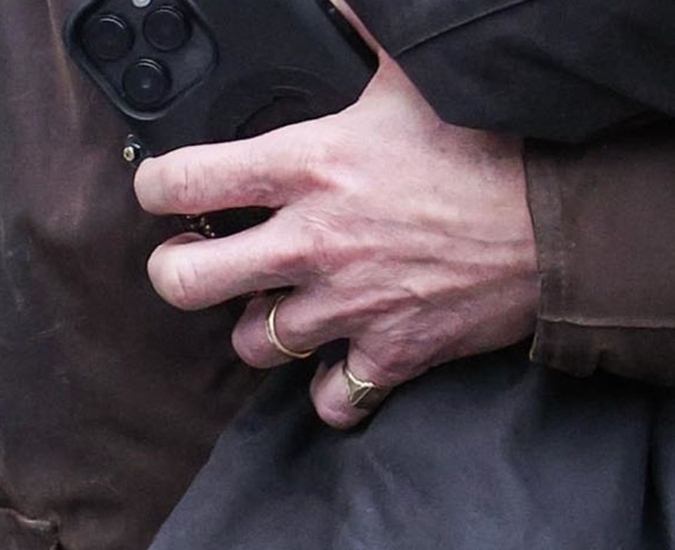 Close-up of Richard Hammond's hand, showing wedding ring.