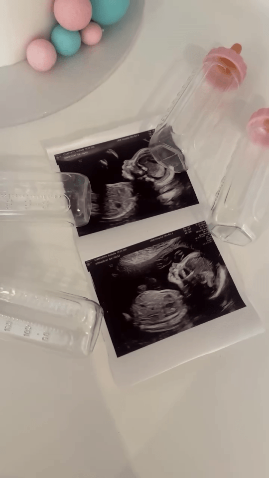 Ultrasound images and baby bottles on a table.
