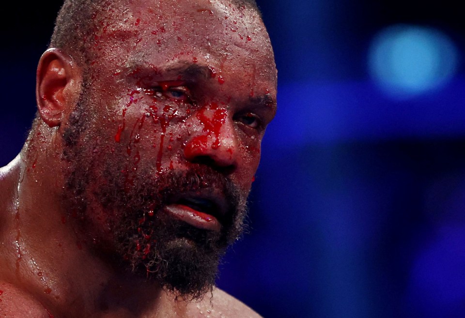 Bloody boxer Derek Chisora.