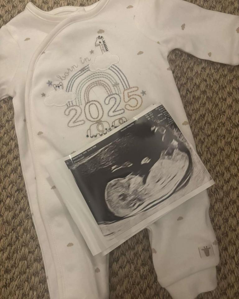 Baby's onesie with "born in 2025" and ultrasound image.