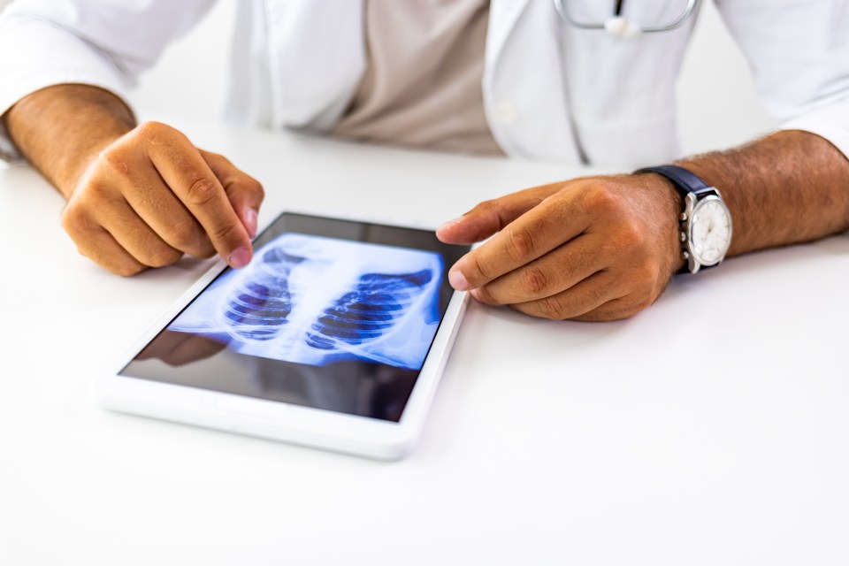 Doctor reviewing chest x-ray on a tablet.
