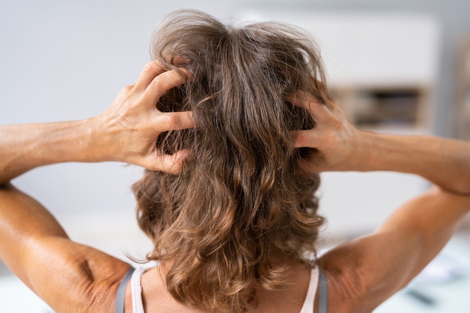Woman scratching her itchy scalp.