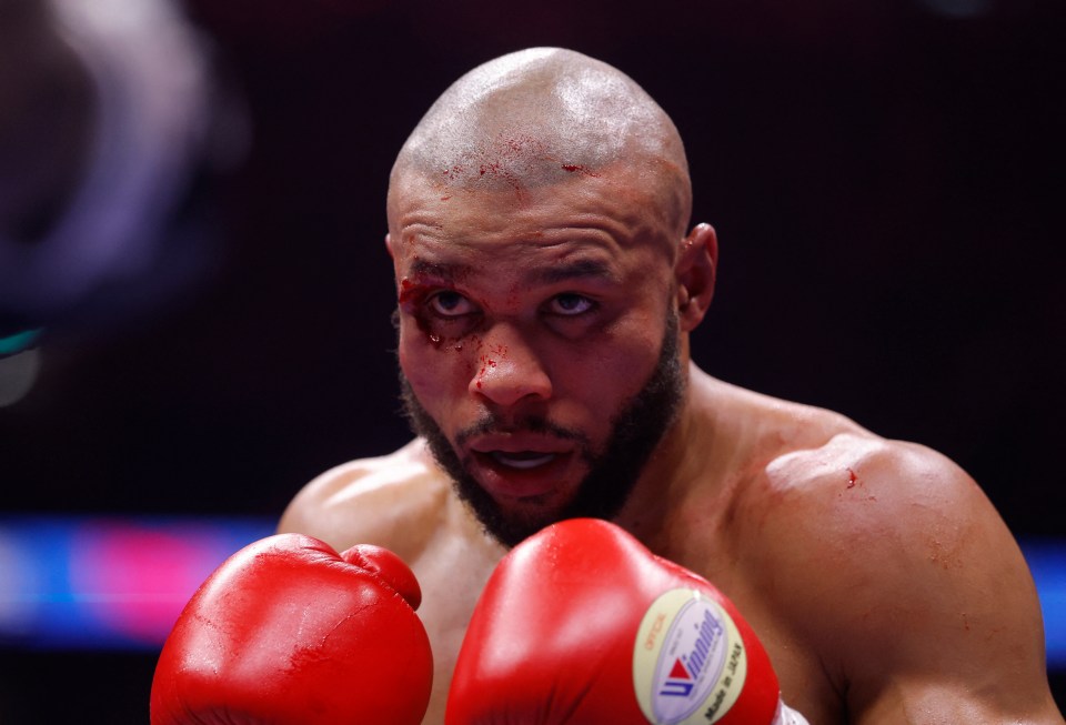 Chris Eubank Jr. with cuts and bruises during a boxing match.