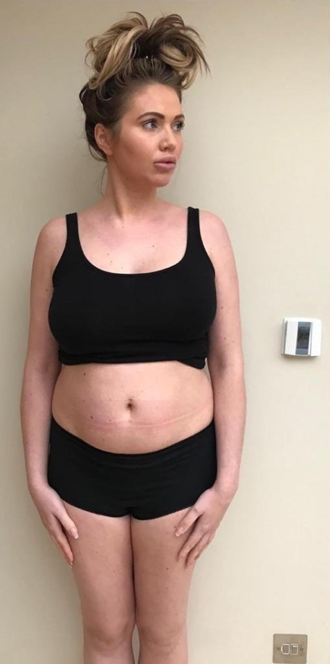 Before and after photos of Amy Childs' body transformation.