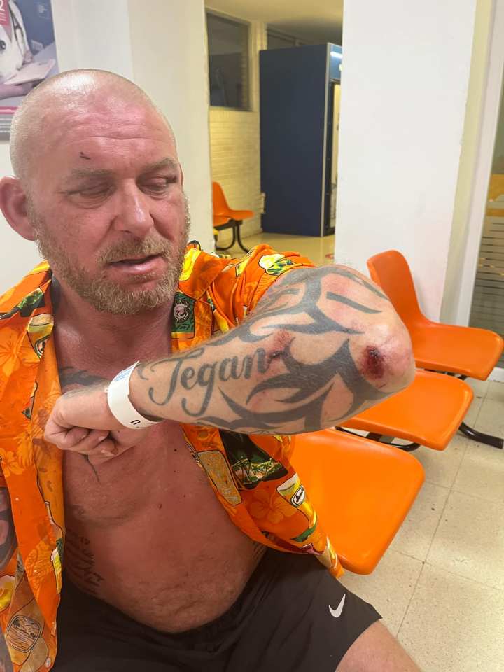 Man with injuries to his face and elbow.