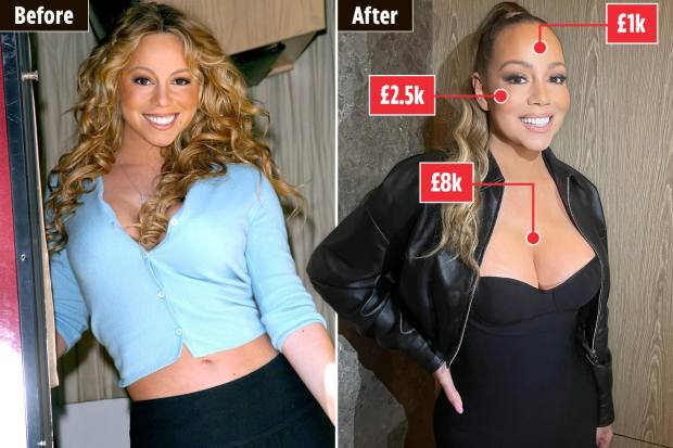 Before and after photos of Mariah Carey with estimated costs of cosmetic procedures.