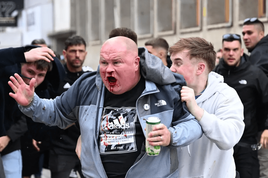 A bloody man being helped by another man amidst a crowd.