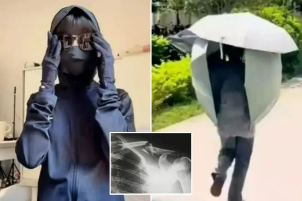 An image collage containing 3 images, Image 1 shows Person wearing a dark blue zip-up jacket, sunglasses, and gloves, Image 2 shows Person walking while carrying a large umbrella, Image 3 shows X-ray of a fractured shoulder