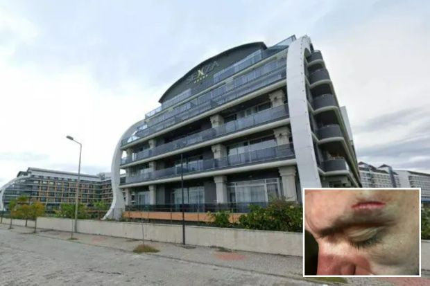 An image collage containing 2 images, Image 1 shows Senza Hotel in Alanya, Turkey, Image 2 shows Close-up of a man's forehead showing a cut