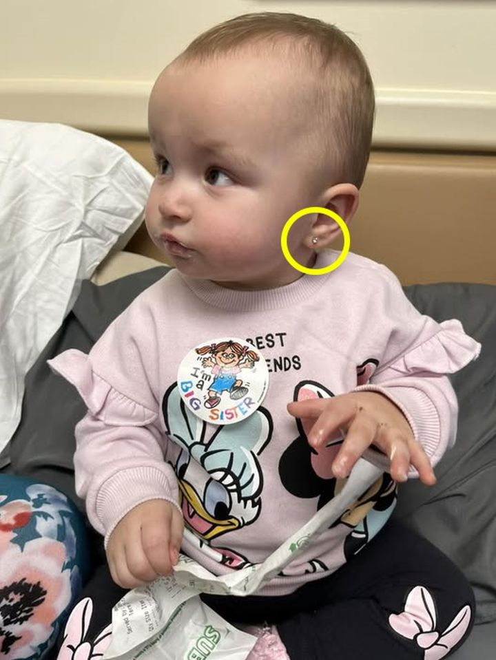 A baby girl with a newly pierced ear.